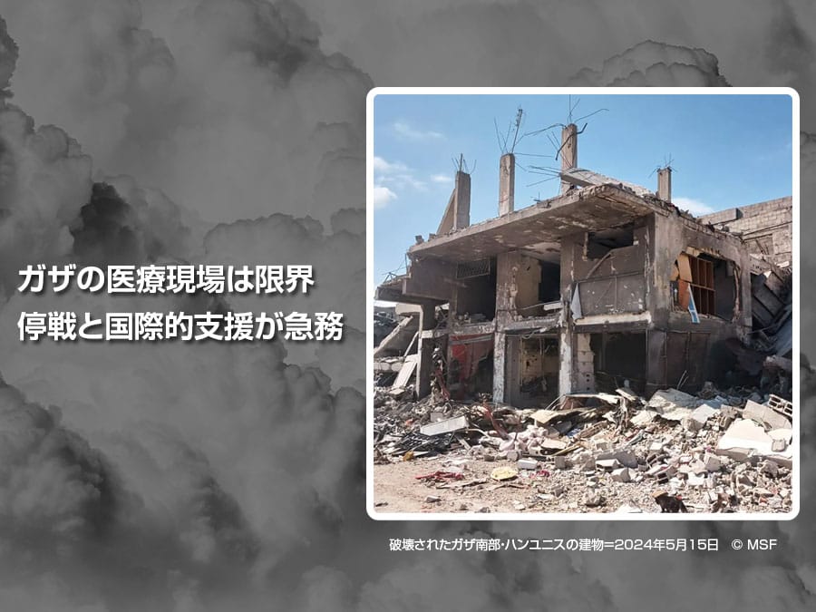 紛争から1年ガザの医療現場は限界：即時停戦と国際的支援が急務