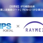 iPS細胞由来角膜再生医療で治験開始