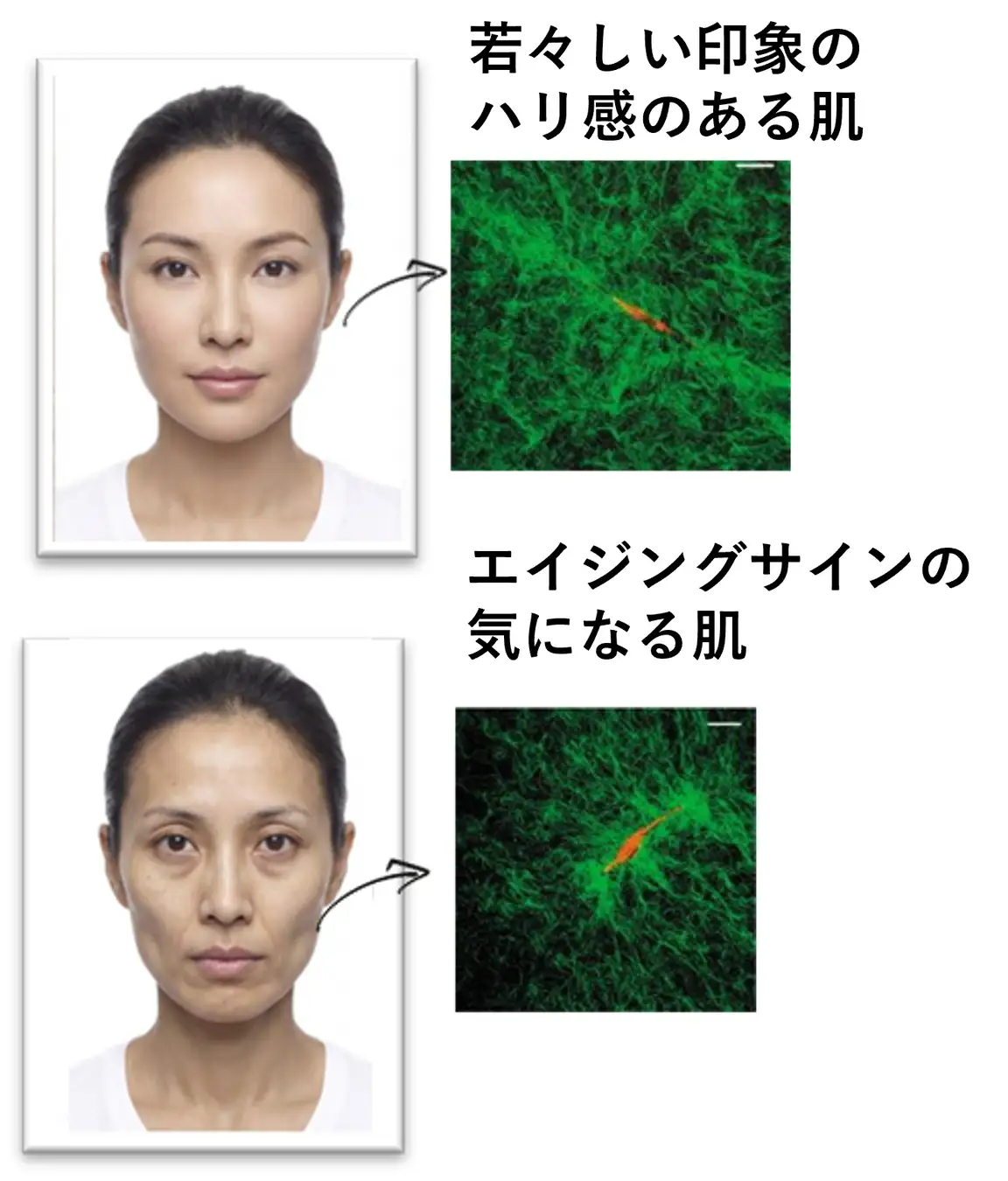 ハリと弾力感のケア